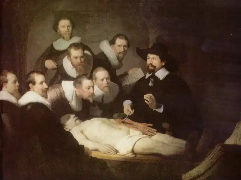 Une fistule anale pour le roi Louis XIV, la maladie et les opérations - Rembrandt | Domaine public