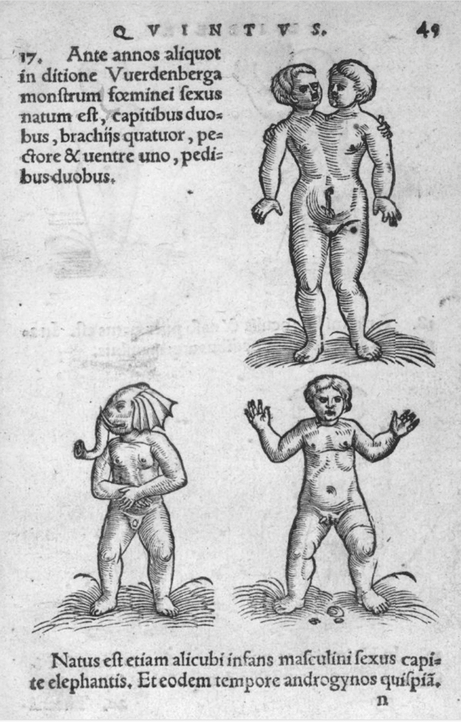 Enfant à deux têtes, enfant à tête d'éléphant et enfant hermaphrodite, De conceptu et generatione hominis, 1554, Jakob RUF