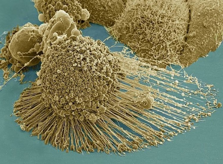 Micrographie électronique à balayage d'une apoptose des cellules HeLa | Domaine Public