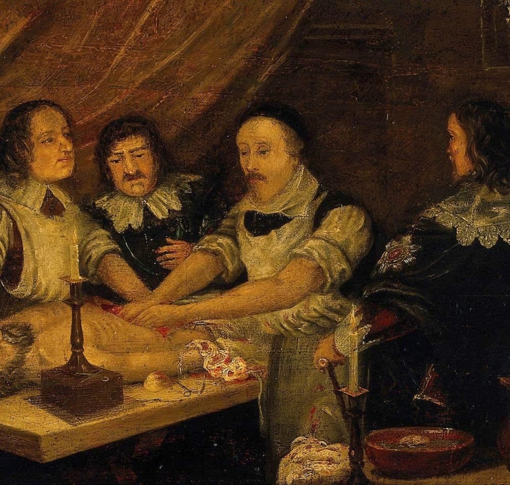 L'huile sur toile "William Harvey disséquant le corps de Thomas Parr" (alias Old Tom Parr), vers 1900 - Auteur inconnu, Wellcome Library (Londres) I Licence CC BY 4.0